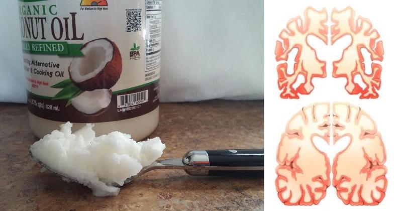 coconut oil brain